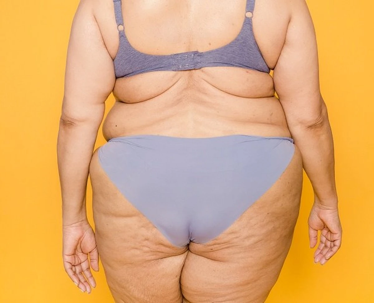 Proč se stáváme „američany s nadváhou“? Doktor Mjasnikov odhaluje překvapivé řešení - image 1